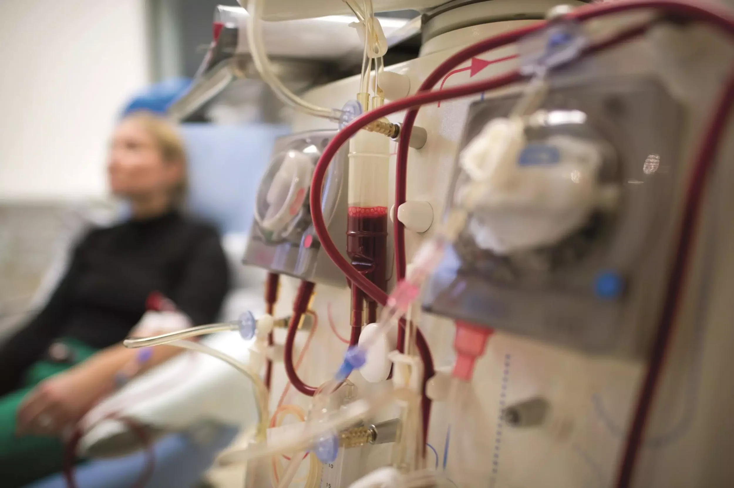 Hemodialysis