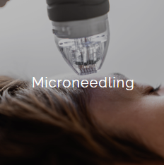 A person receiving a microneedling treatment with a device near their face, with the word 'Microneedling' overlayed.