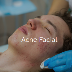 Close-up of a person's face with acne, lying down with eyes closed, receiving facial treatment from a practitioner wearing blue gloves.