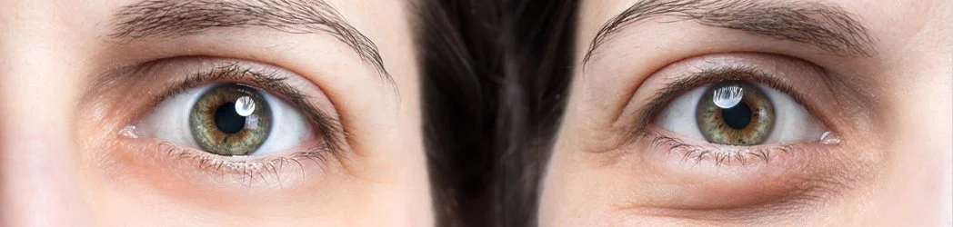 Mistakes You’re Making That Are Aging You