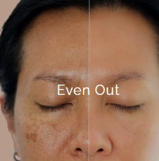 Side-by-side comparison of a woman's face showing uneven skin tone with age spots on the left and clearer skin on the right, labeled 'Even Out'.