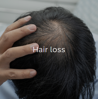 Close-up of a person's scalp showing hair loss, with a hand touching the head.