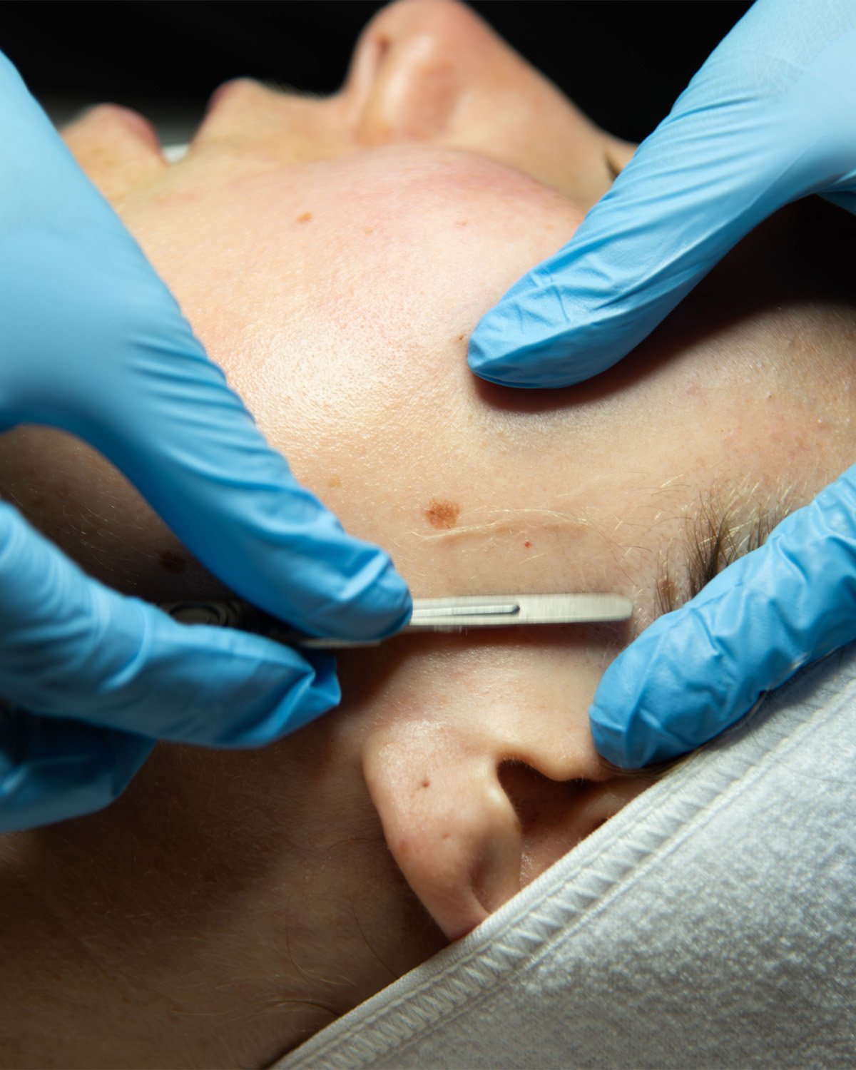 A person receiving a facial treatment with a metal tool on their cheek, wearing a white head covering, while a practitioner in blue gloves holds the person's face.