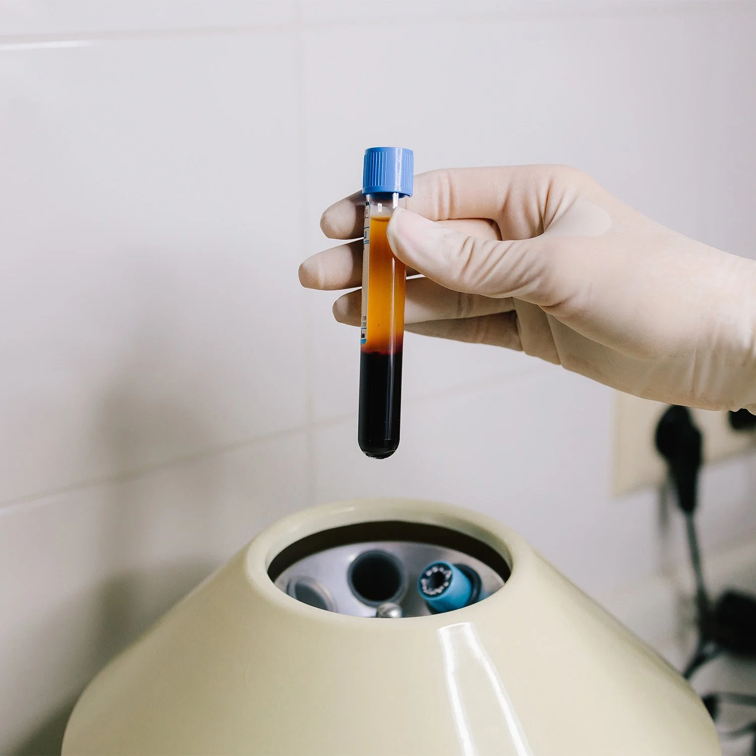 A gloved hand holding a test tube with blood, ready for analysis, over a medical centrifuge in a laboratory.