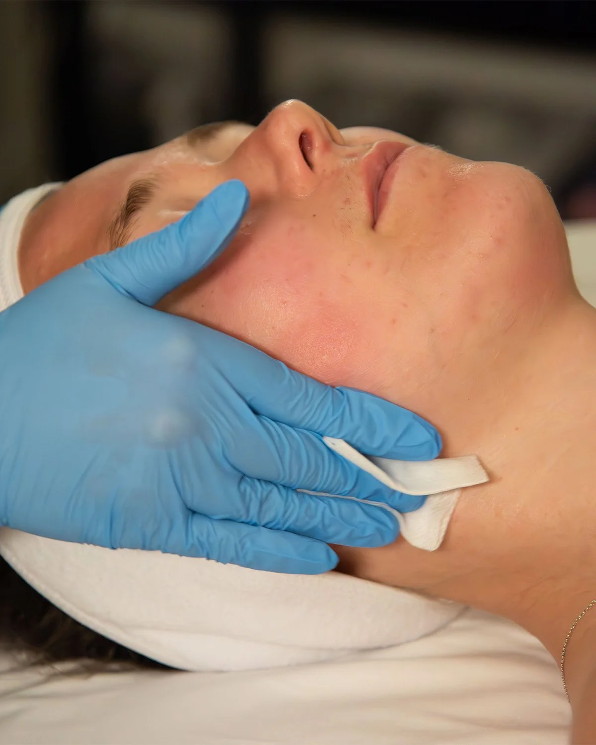 A person receiving a facial treatment, with a gloved hand gently holding their chin, and a cotton pad on their jawline.