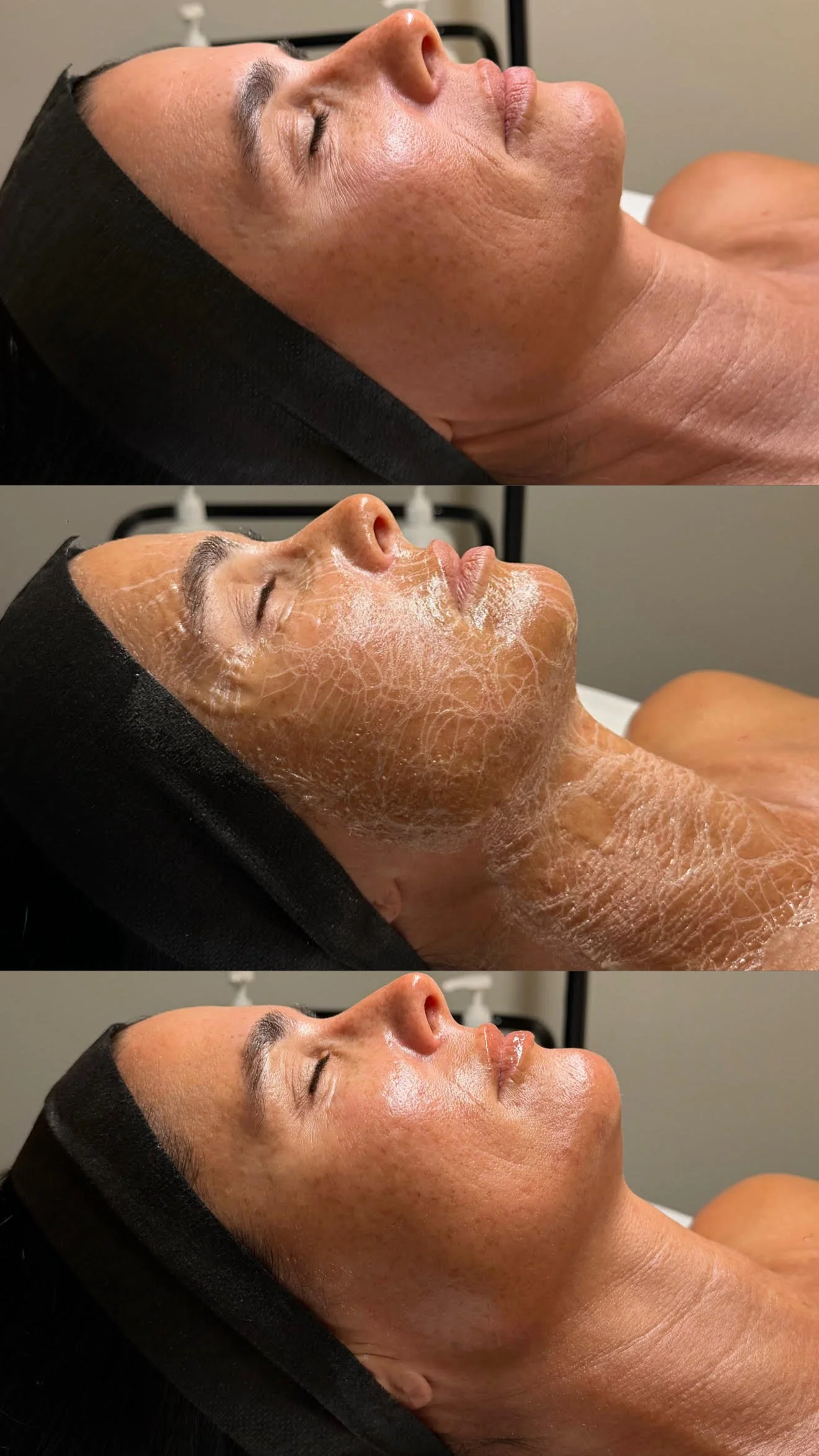 Collagen Peptide Facial 