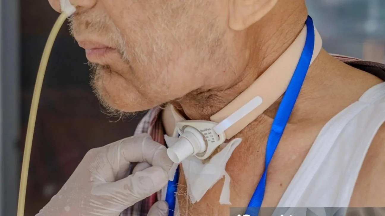 Ventilator & High-Acuity Support (Within CNA Scope)