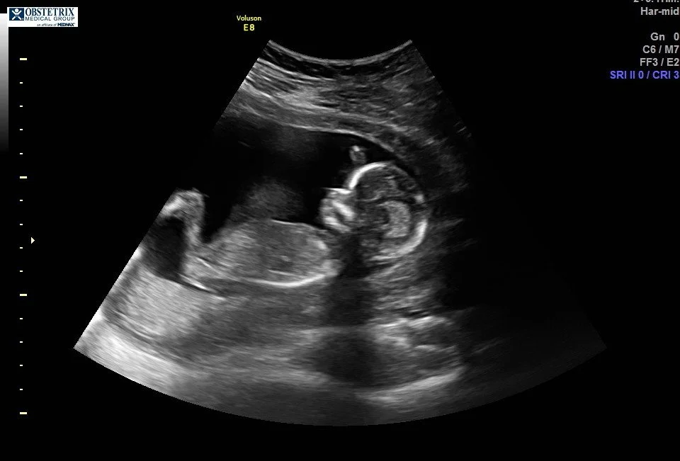 Pregnancy Update: 17 Weeks (with Marae)