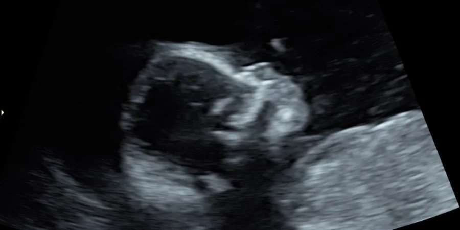 Pregnancy Update: 18 Weeks