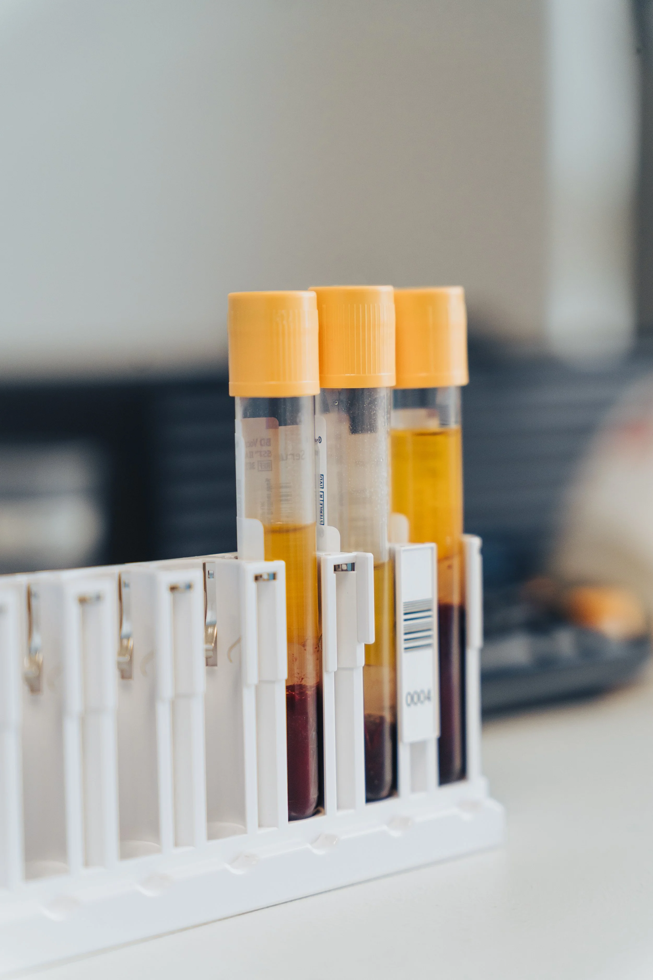 Laboratory test tubes with blood samples in a white rack.