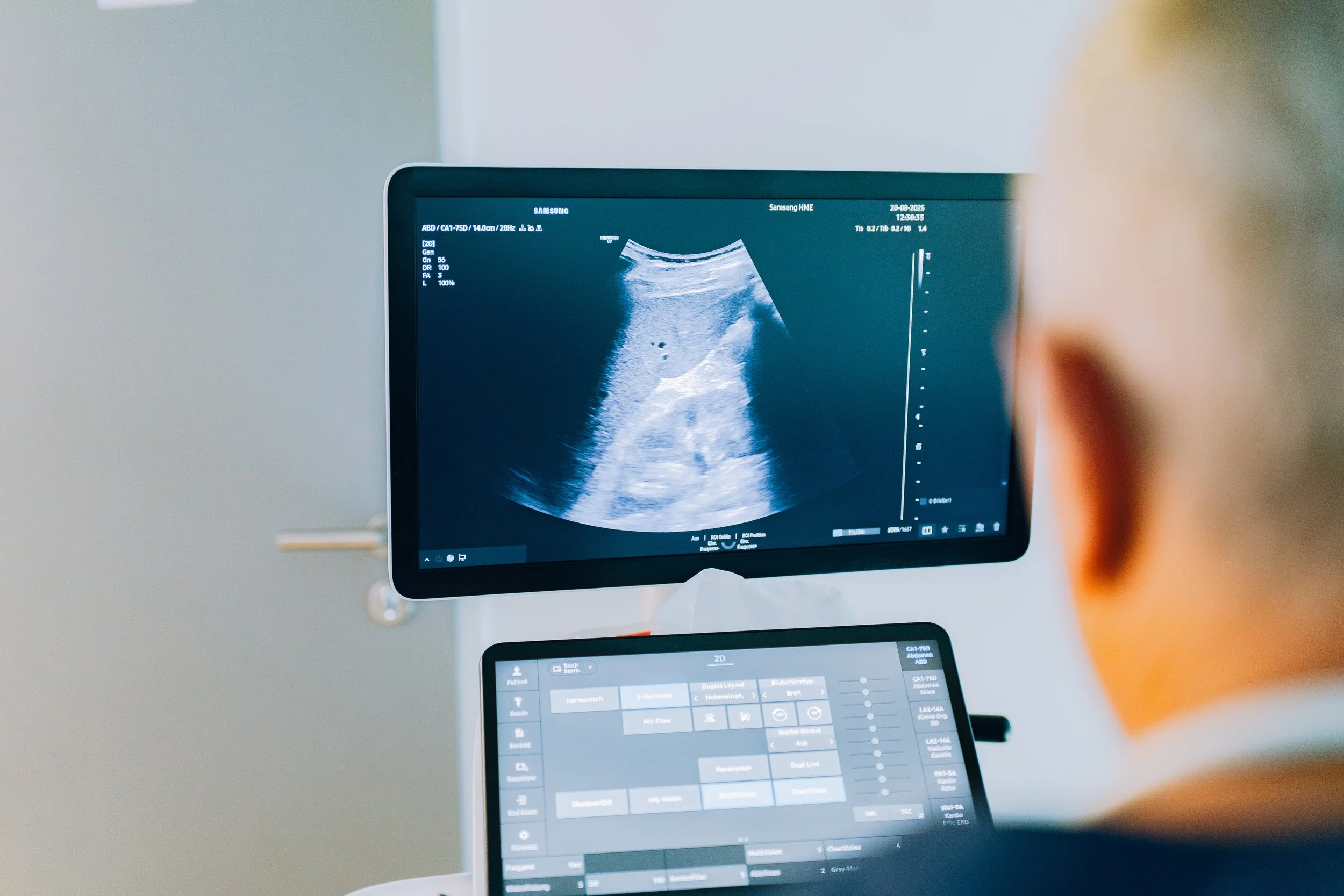 Person viewing an ultrasound image on a computer monitor in a medical setting.