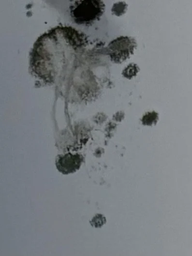 This is what was growing on the ceiling in our living room. We had multiple areas with various molds.