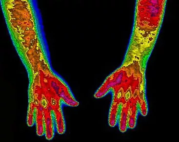 Thermal image of two hands with color gradients indicating temperature variations.