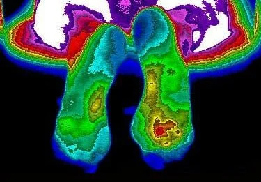 Infrared thermal image of two human feet.