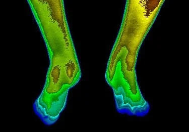 Color-coded thermal image of two leaned legs with varying temperatures.