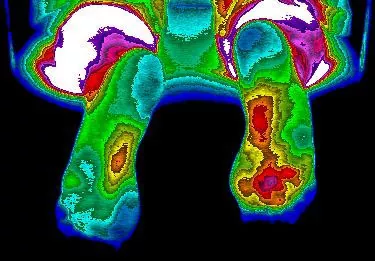 Colorful heat map of the human pelvic region and thighs, showing temperature variations.