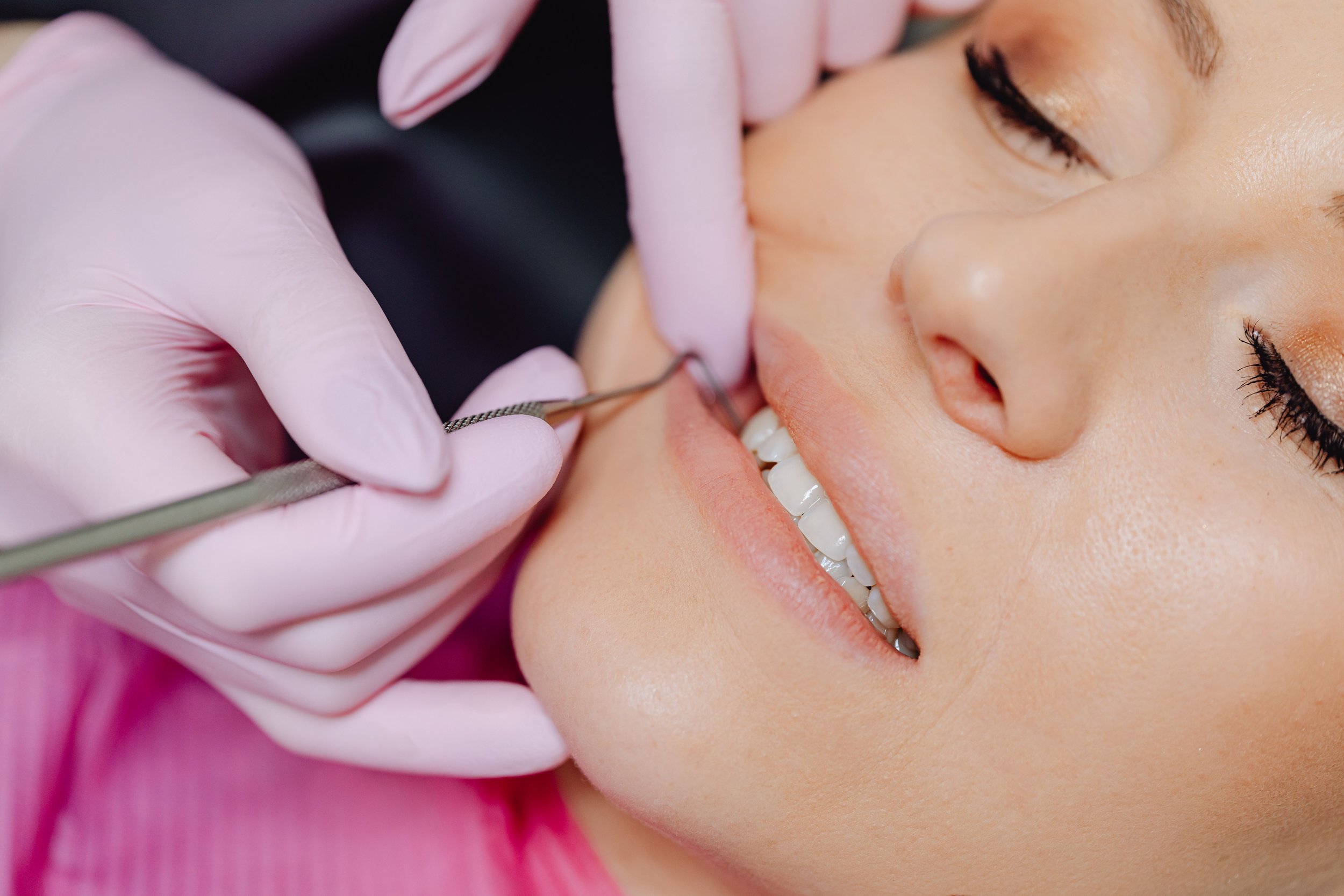 What Is Periodontal Scaling and Root Planing and Who Actually Needs It