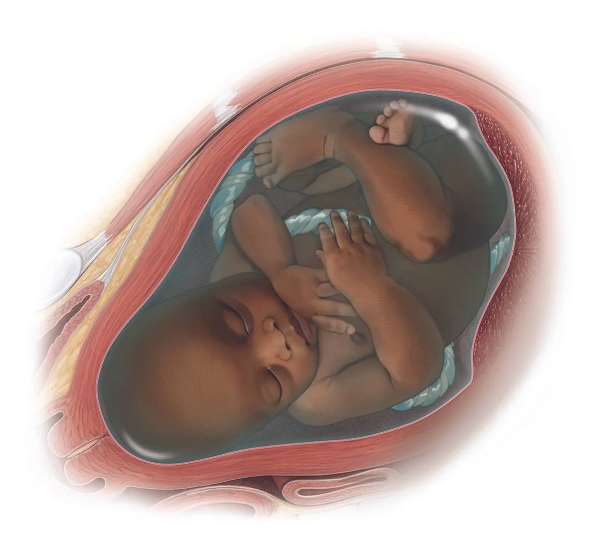Full term fetus