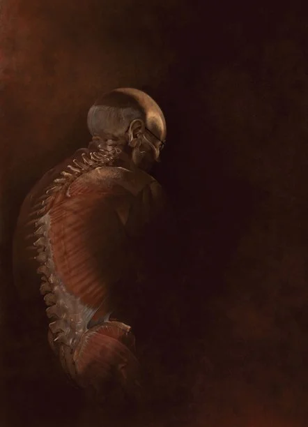 Illustration showing an elderly patient exhibiting Postural Dysadaptation Syndrome