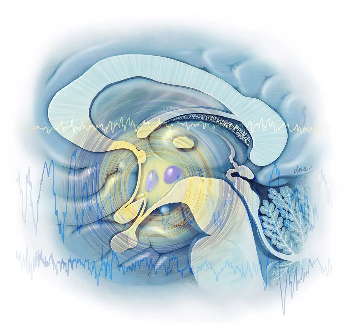 Cognitive Behavioral Therapy for Sleep