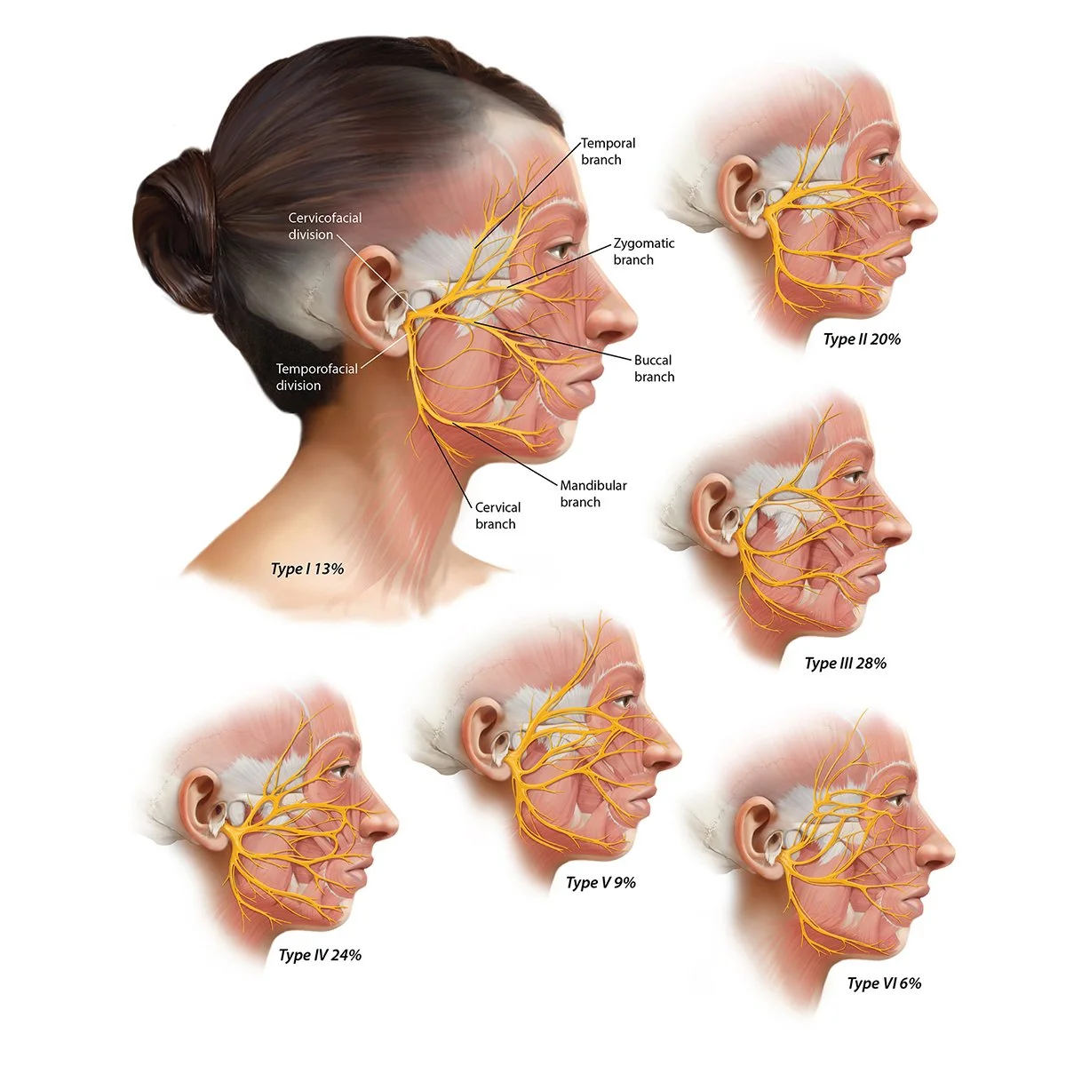 Illustration of Facial Nerve