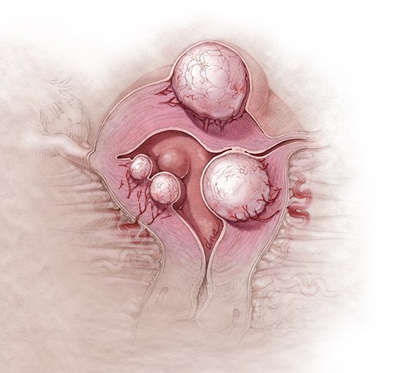 Featured in Contemporary OB/GYN