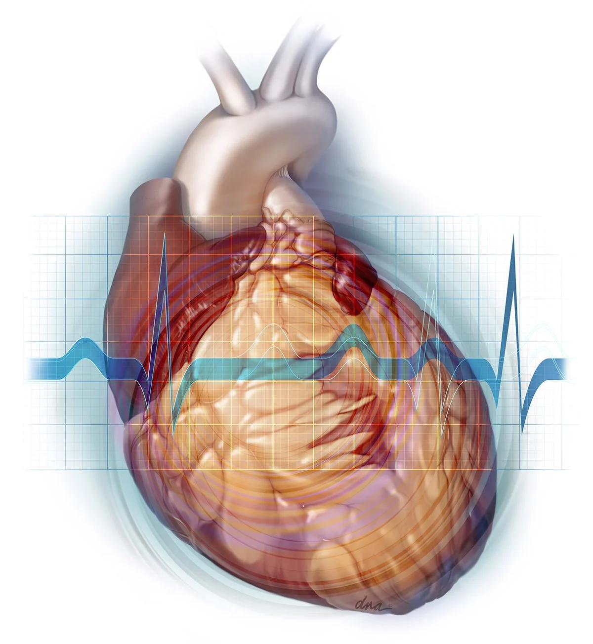 Cardio-Oncology Discussing Heart care in Cancer Patients