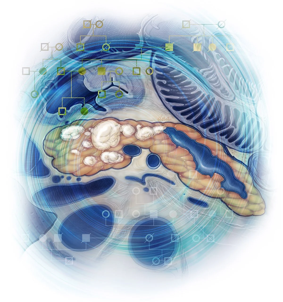 Genetic Testing for Pancreatic Ductal Adenocarcinoma