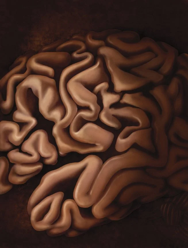 Close up of the lateral region of the brain showing structural changes in Alzheimer's