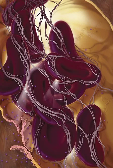 Medical illustration showing fibrin fibers starting to form a clot