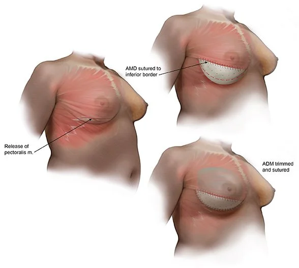 Surgical Illustrations of Reconstructive Surgery
