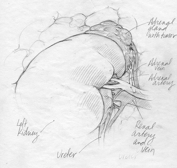 Sketch of a surgical illustration showing the blood supply to the left kidney and adrenal gland