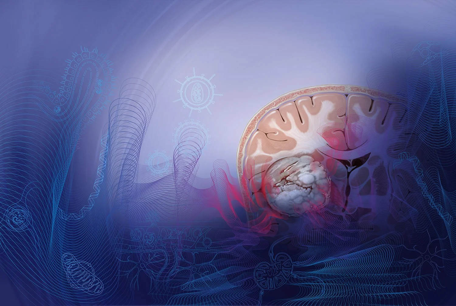 Two page spread on merging therapies for Glioblastoma