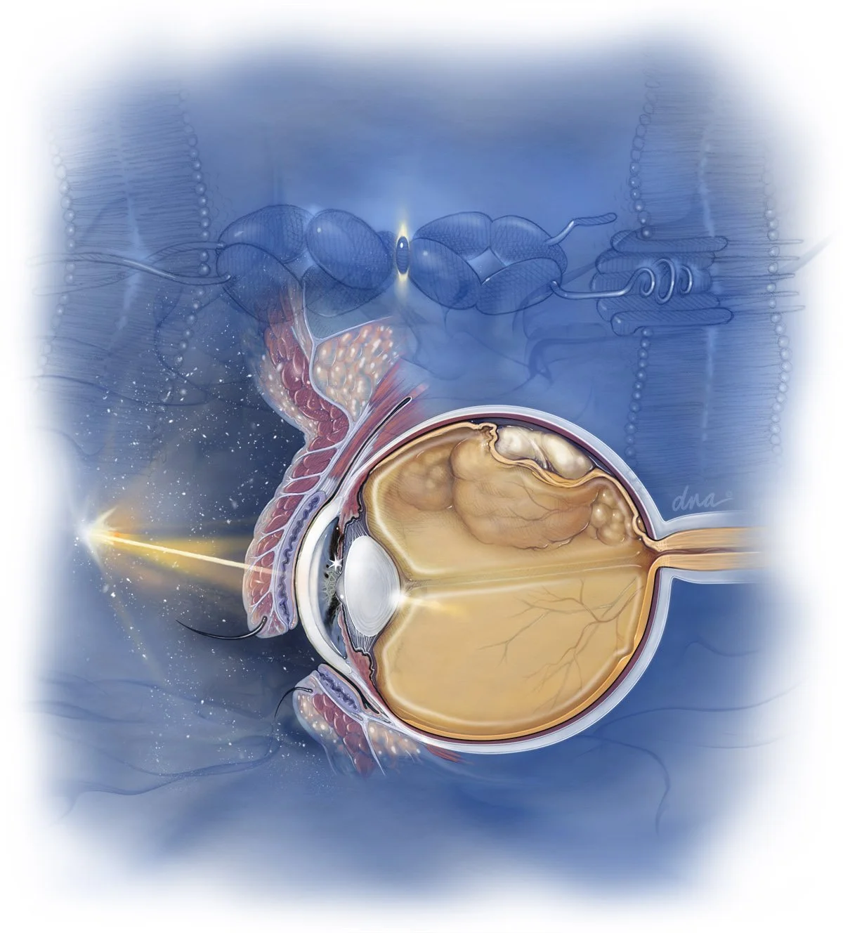 Treatment of Uveal Melanoma