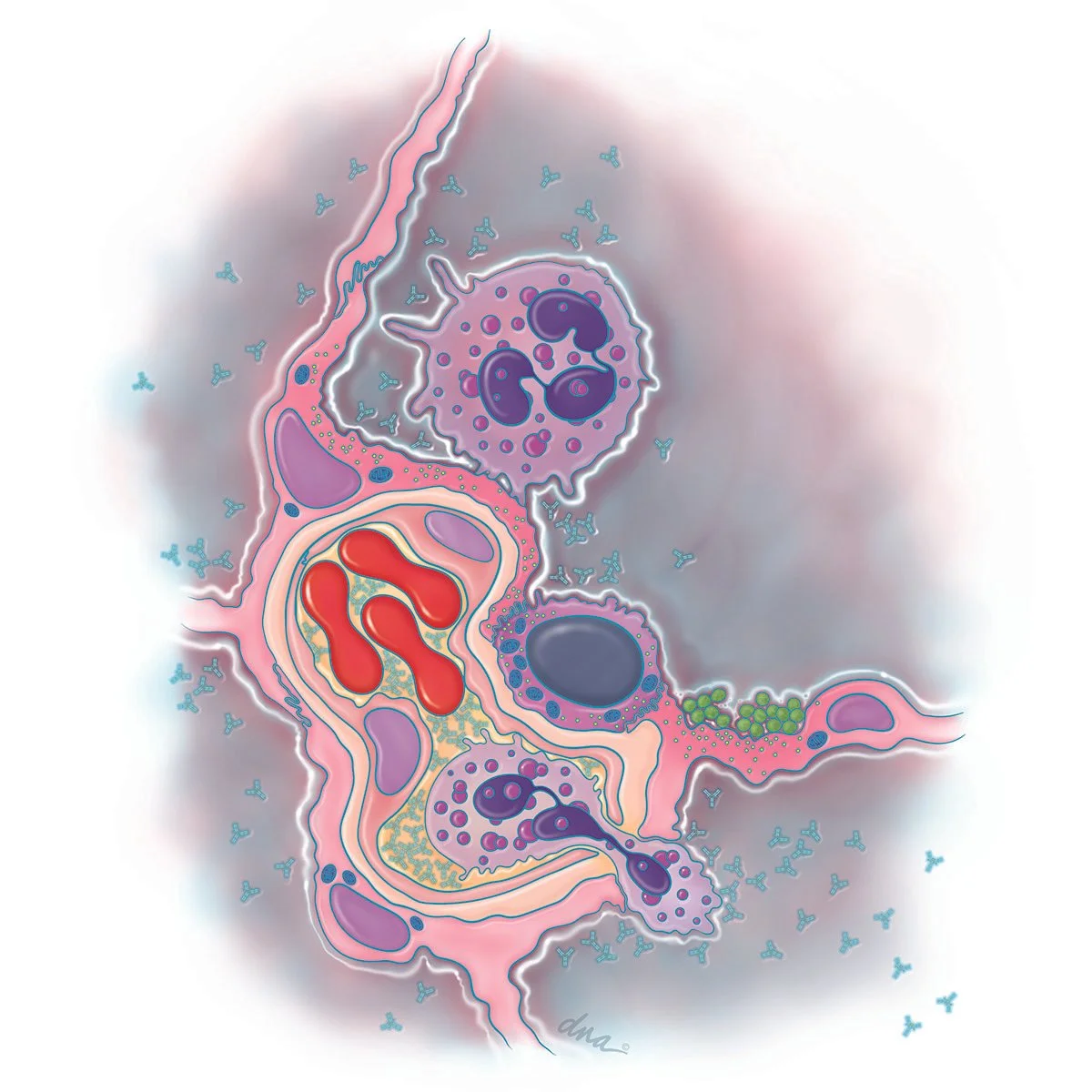 Drug Induced Pneumonitis
