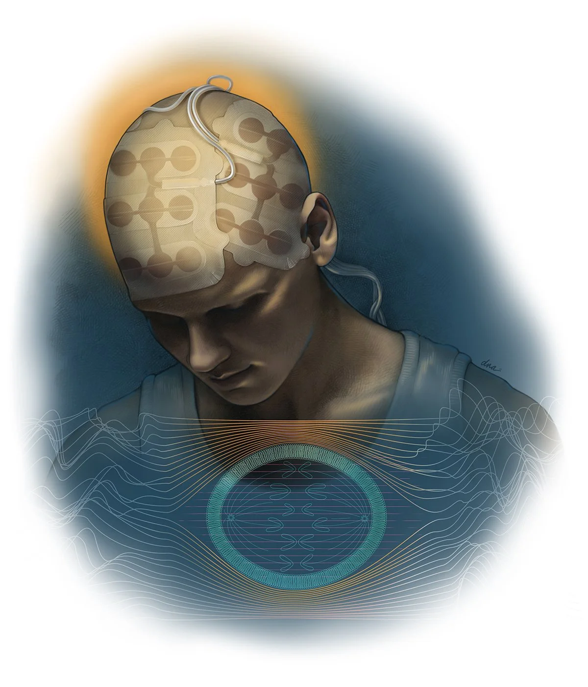 Magnet Tumor Treating Fields for Solid Tumors