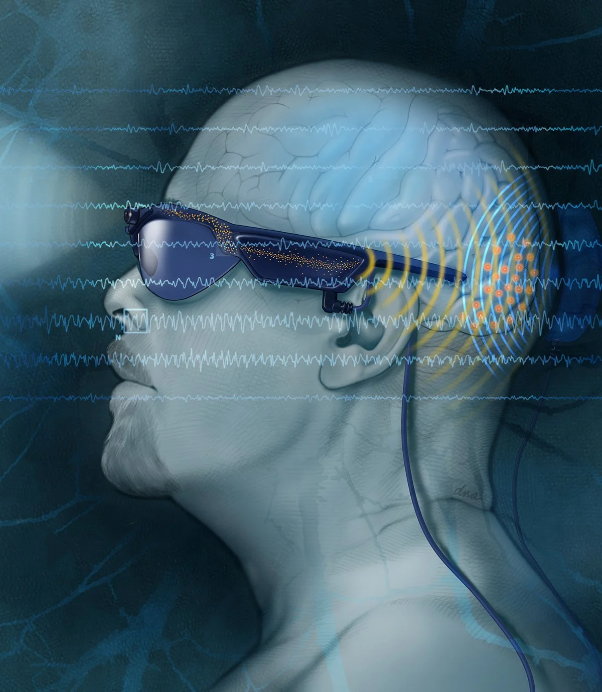 Cortical Visual Prosthesis System for Artificial Vision created for the Artificial Organs Journal