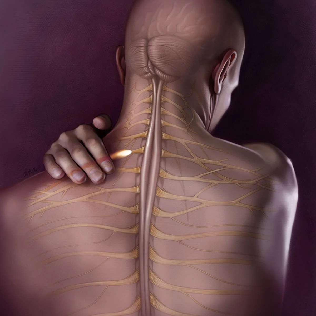 Illustration for article on treatment of generalized pain with OTC pharmaceuticals