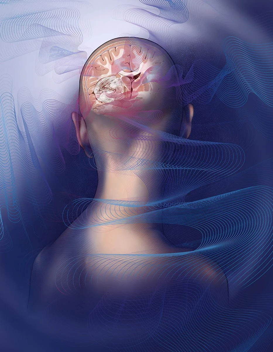 Weaving Together Various Treatment Modalities for Glioblastoma featured on the cover of the Rogel Cancer Center’s annual publication Illuminate, which highlights advances in cancer research.