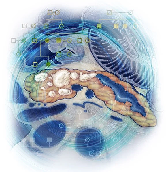 Editorial illustration of Genetic Associations with Pancreatic Cancer