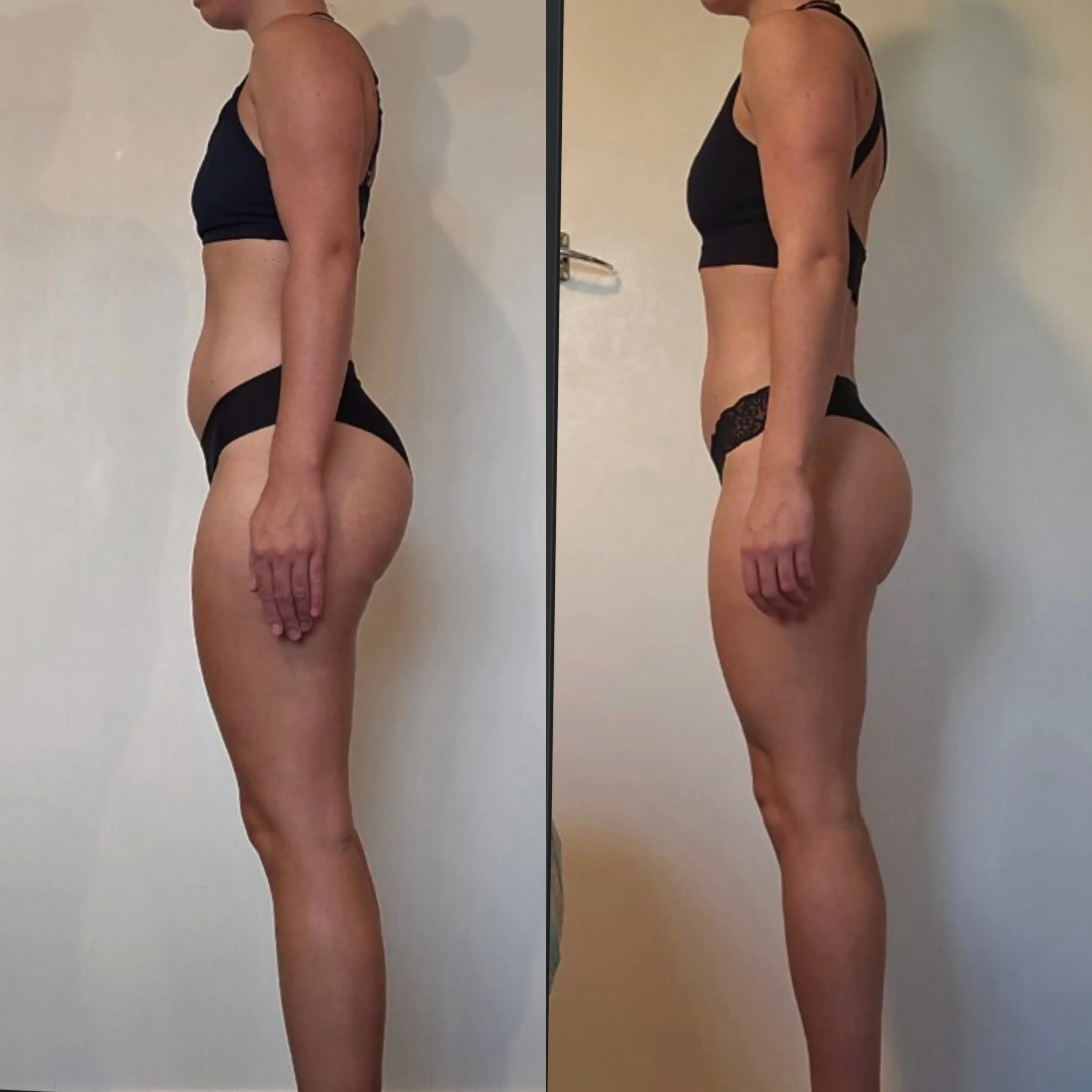 glute and stomach transformation. female is more defined in the right pic
