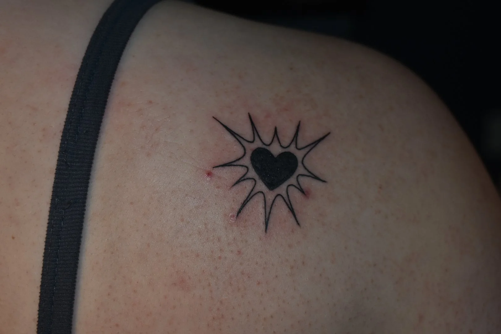 Tattoo of a solid black heart inside an outline with radiating lines, on fair skin with visible freckles and some redness around the tattoo.