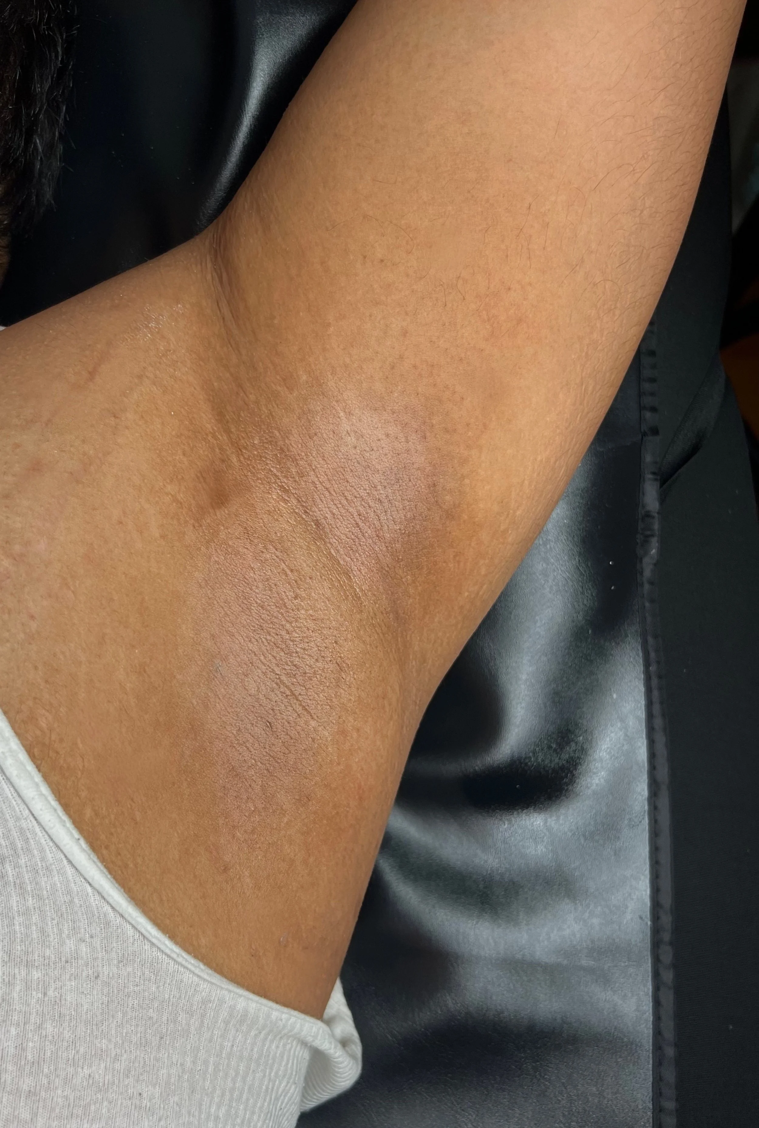 Close-up of a person's armpit with smooth, brown skin and some fine hair, taken against a dark background in hazleton wax studio