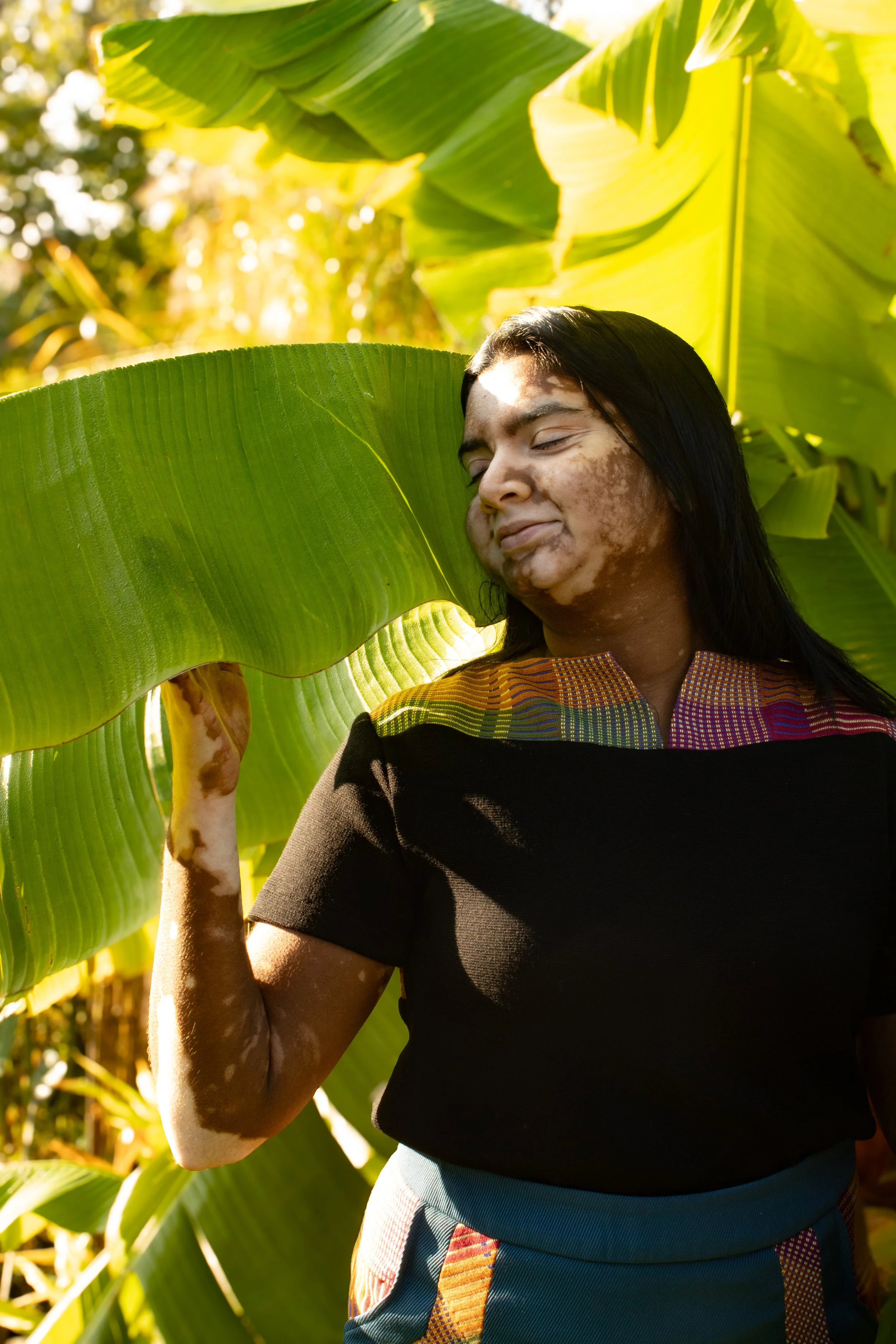 photo de marque femme sage pour réseaux sociaux et e-commerce en Essonne (91) Une femme souriante avec des taches de vin jaune sur le visage, portant un vêtement coloré, dans un champ de feuilles de bananier