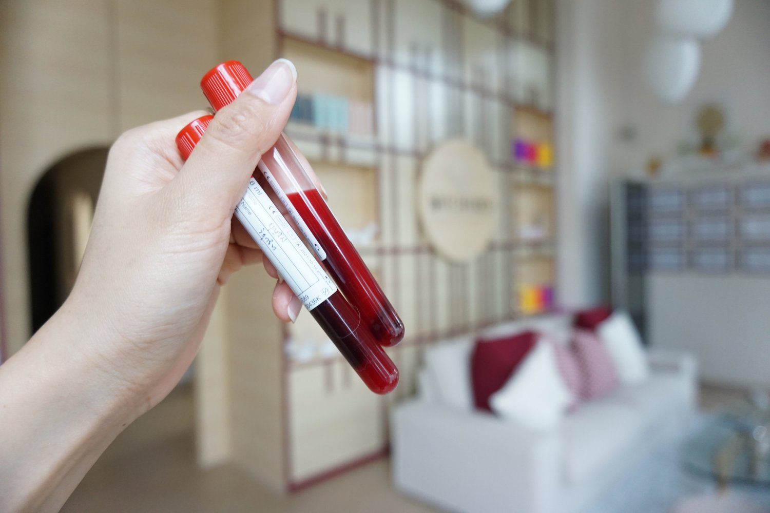 การเก็บตัวอย่างเลือดเพื่อตรวจภูมิแพ้อาหารแฝง IgG ที่ MICHIKO Wellness กรุงเทพฯ