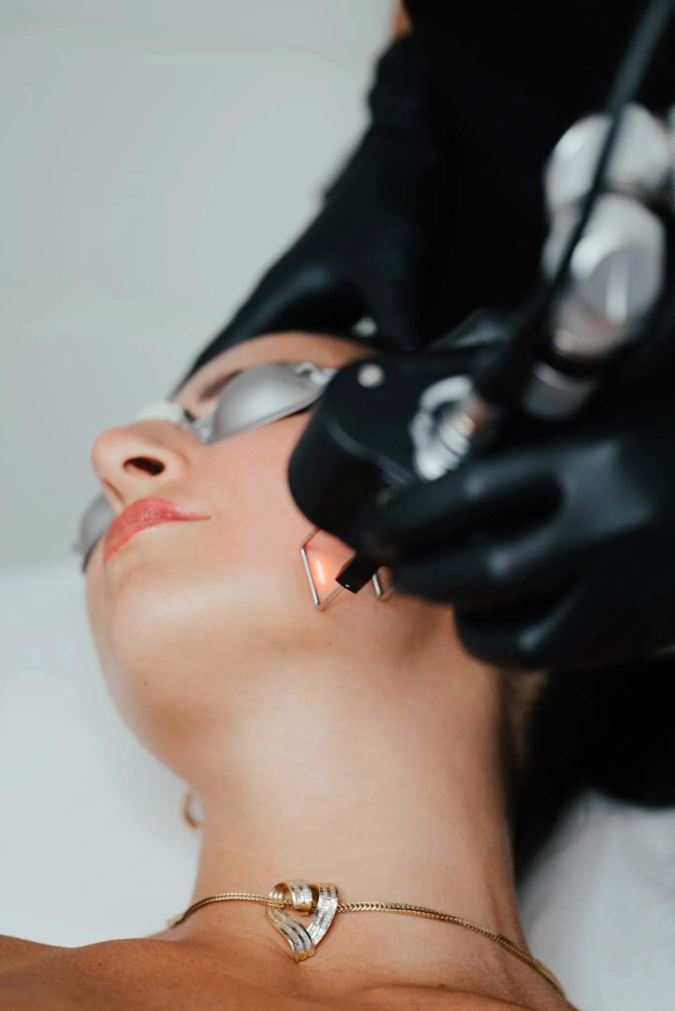 A woman lying down during a laser tattoo removal procedure, wearing protective glasses, with a laser device used on her face.