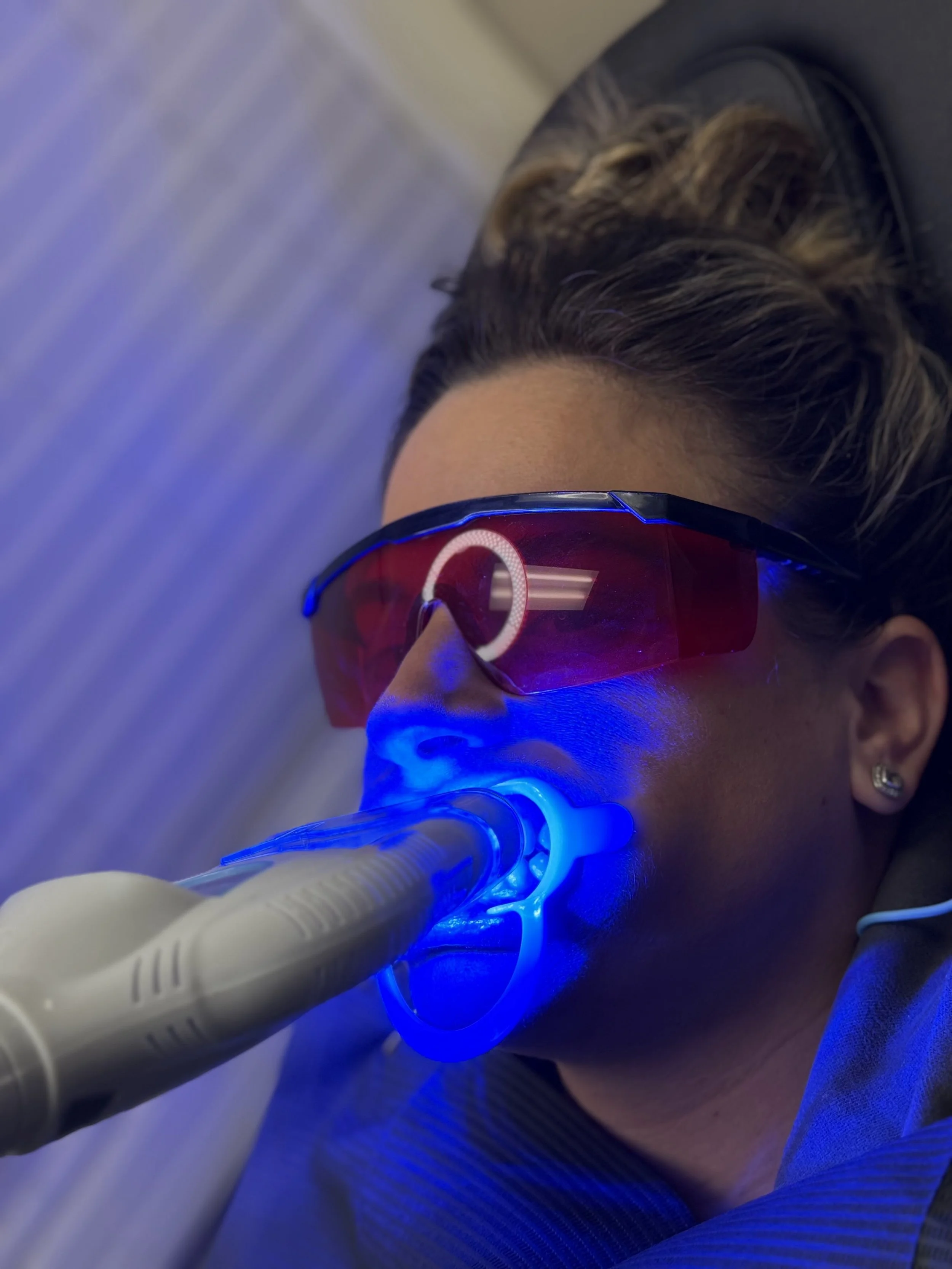 A woman lying down wearing red protective glasses, receiving teeth whitening.