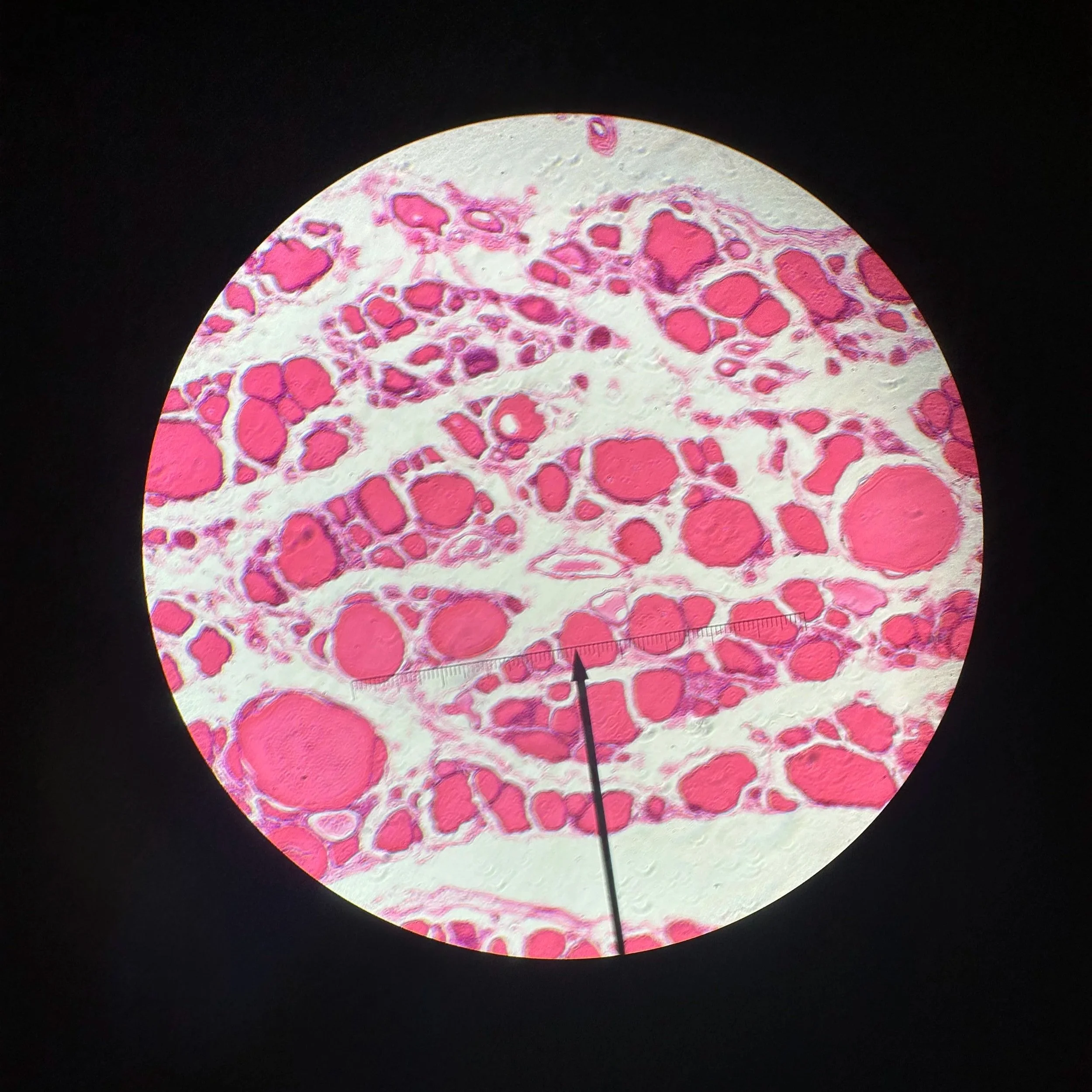 312372 human simple cuboidal epithelium