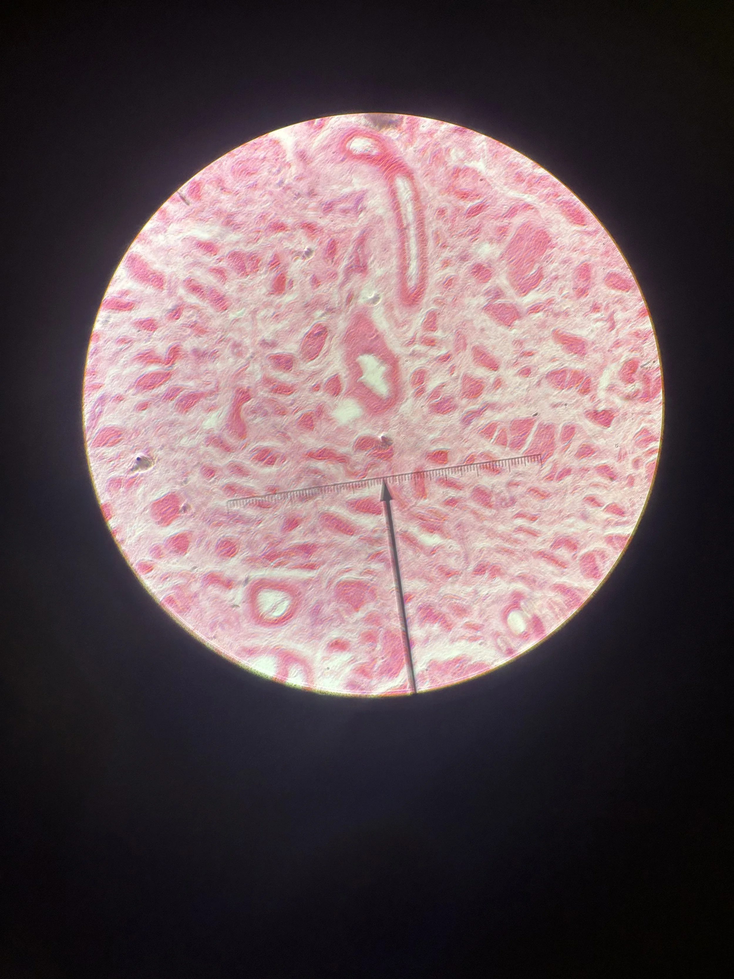 312540 human stratified squamous epithelial