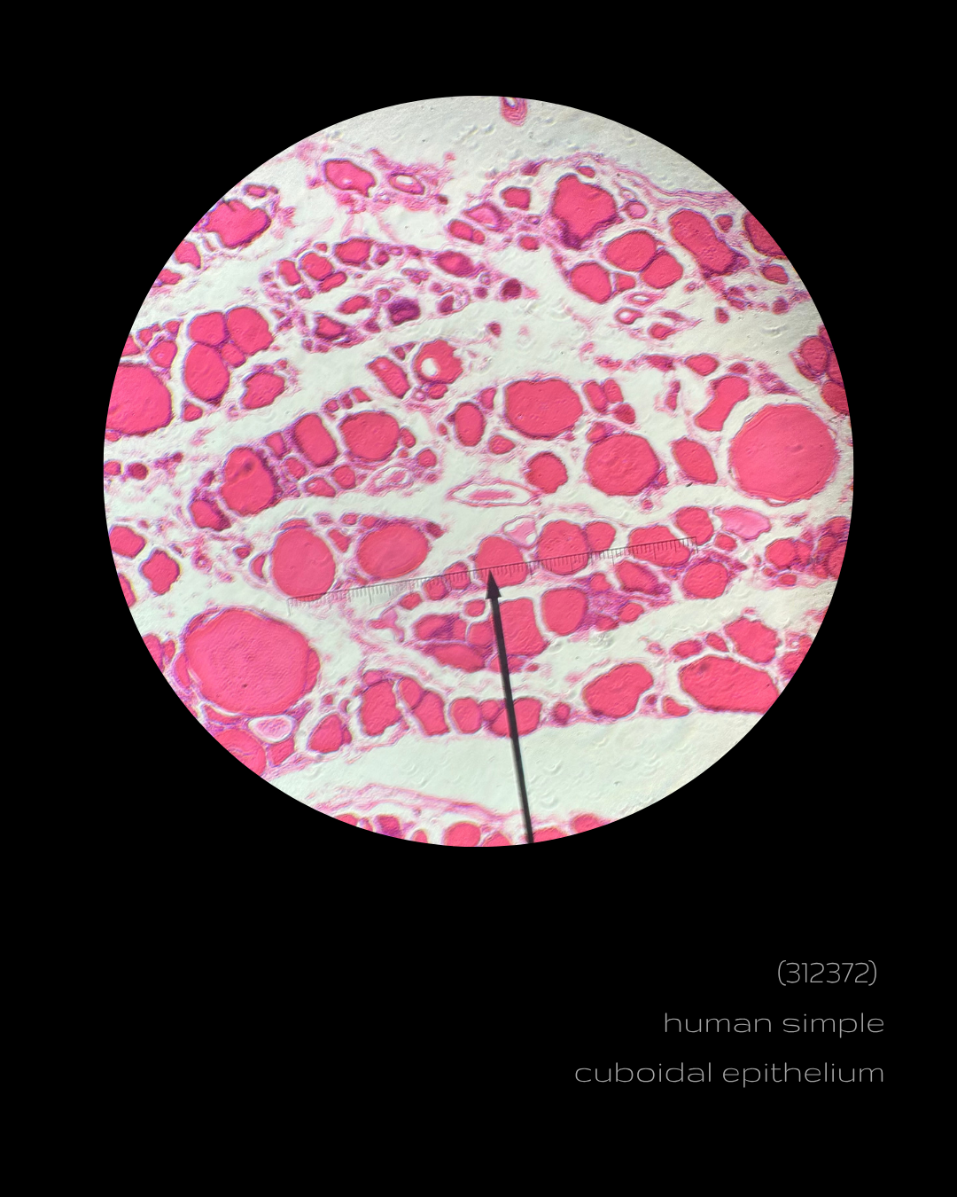 SPLICE - (312372) human simple cuboidal epithelium.png